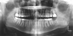 Traditional Film X-Ray