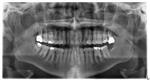 Digital X-Ray